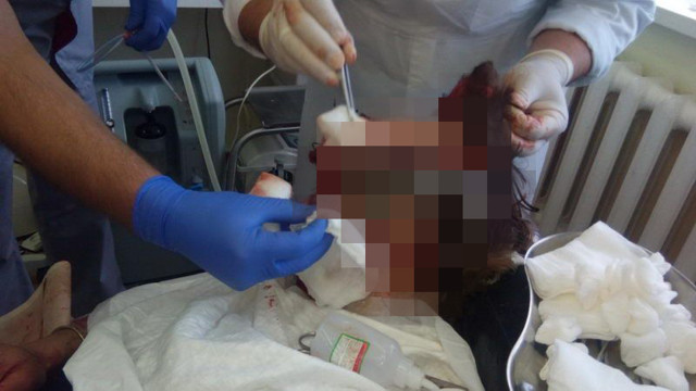 На Камчатке медведь растерзал туристку из Франции