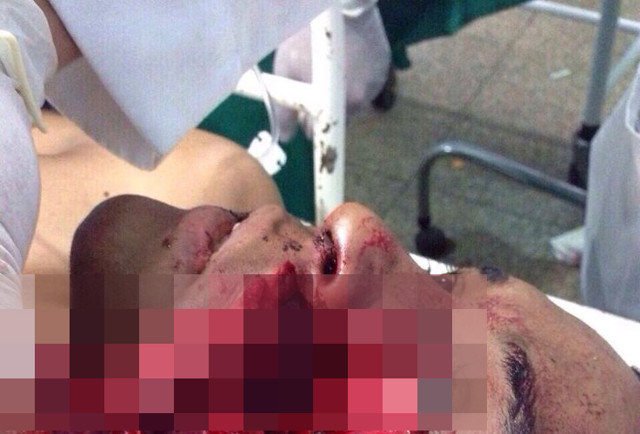 Ковбой получил копытом в лицо