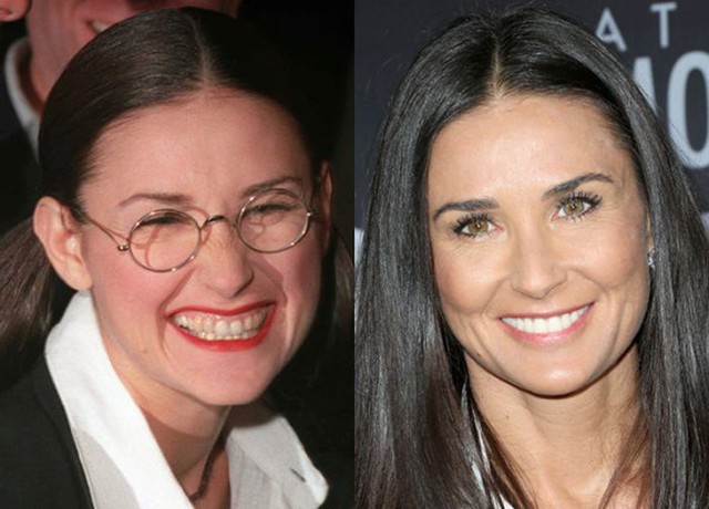 Знаменитости, исправившие себе улыбку ради актерской карьеры