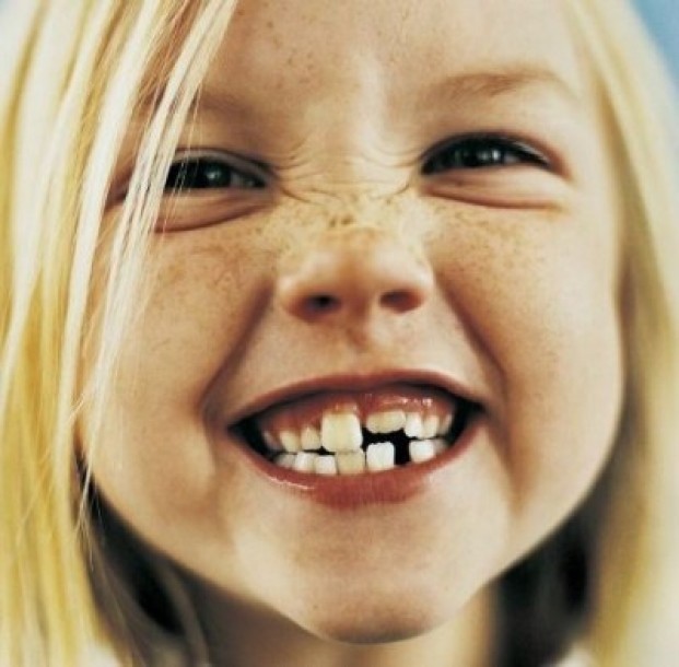 Почему «молочный комплект зубов» меньше, зачем человеку смена зубов