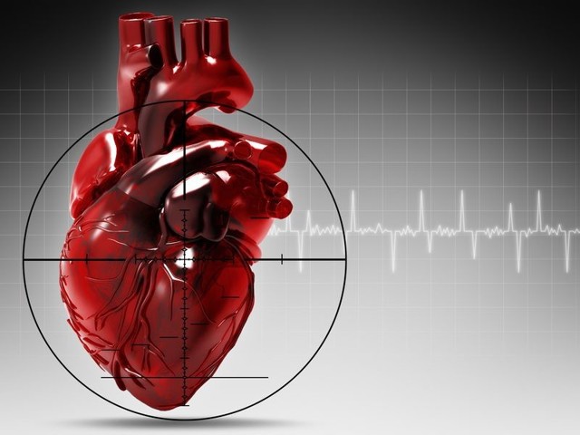 5 признаков инфаркта