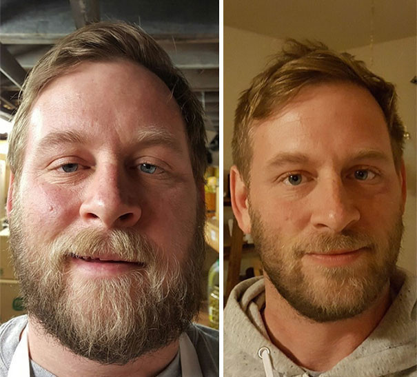 40 фото "до и после": они завязали со спиртным
