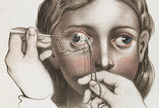 Ужасы викторианской хирургии: подробные иллюстрации