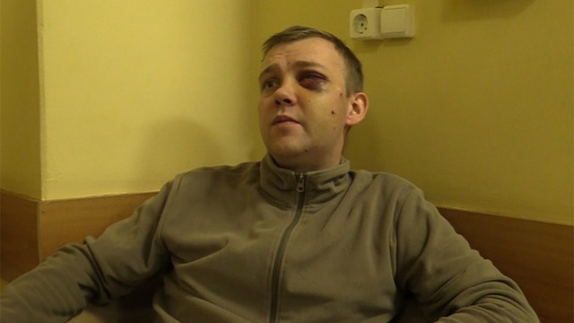 Пассажиру сломали лицевую кость в давке в московском метро