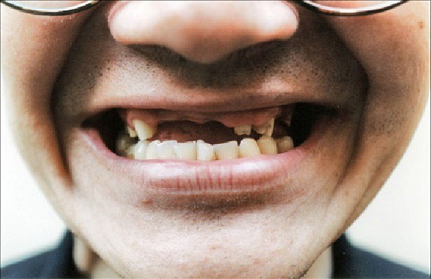 Ужасы соцсетей