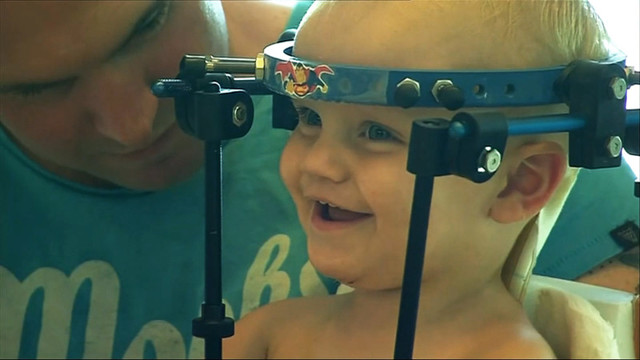 В Австралии врачи пришили обратно оторванную голову ребенка