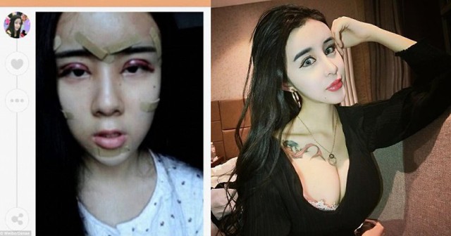 15-летняя китаянка перекроила тело и лицо ради потерянного бойфренда