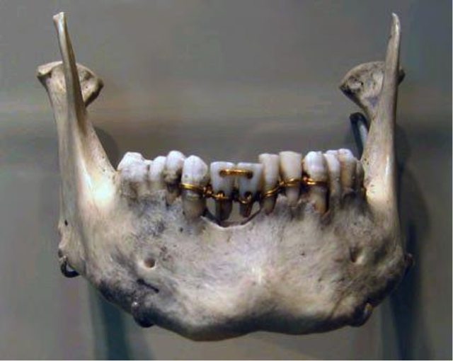 История стоматологии с древнейших времен