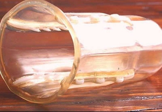 Вот как в Африке решили бороться с насильниками. И врагу не пожелаешь