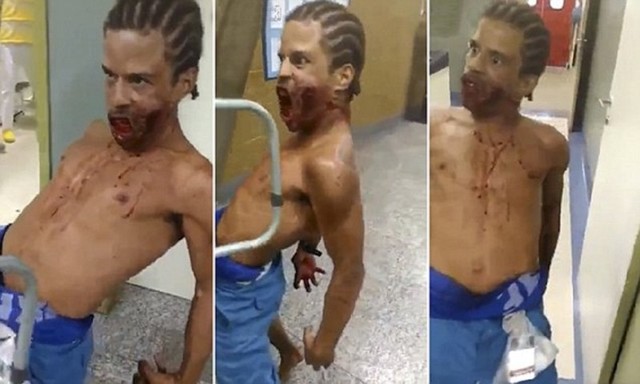 Жуткое происшествие в бразильском госпитале: раненый или одержимый?
