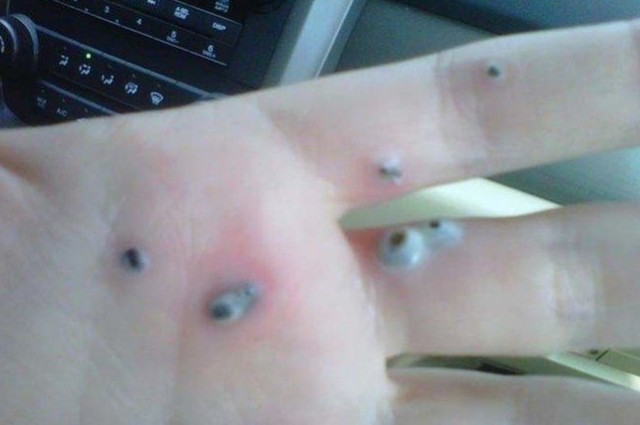 Мужчина заметил странные черные точки на руке жены. Оказалось, что это...О, боже!