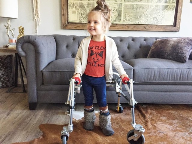 Эта трехлетняя малышка с ДЦП стала новой иконой стиля