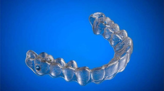 Парень создал с помощью 3D-принтера пластиковые брекеты, чтобы выровнять свои собственные зубы