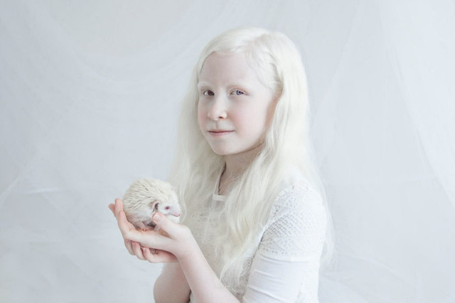 «Фарфоровая красота»: фотопроект о неземном очаровании людей-альбиносов