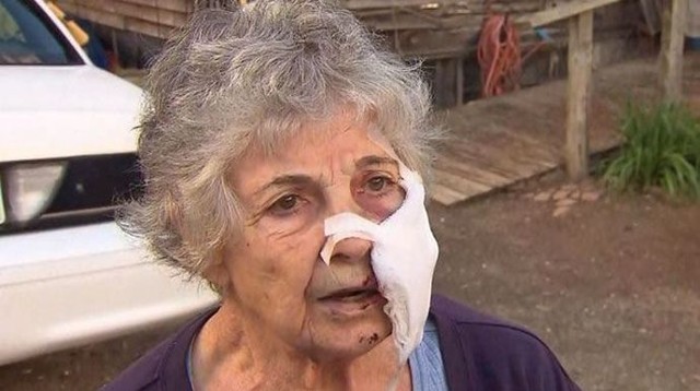 80-летняя женщина пострадала от нападения рыси