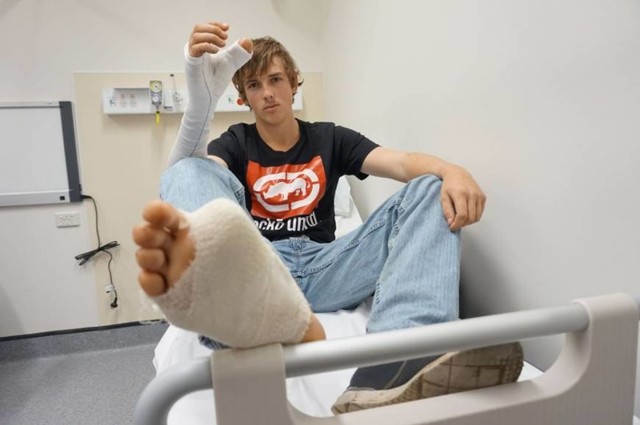 20-летнему фермеру из Австралии успешно пересадили большой палец ноги на руку
