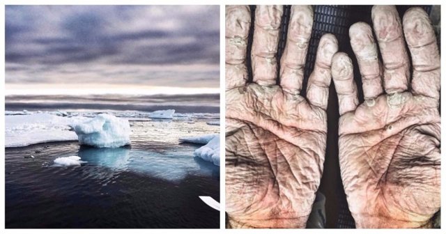 Так выглядят руки олимпийского чемпиона, покорившего Северный Ледовитый океан