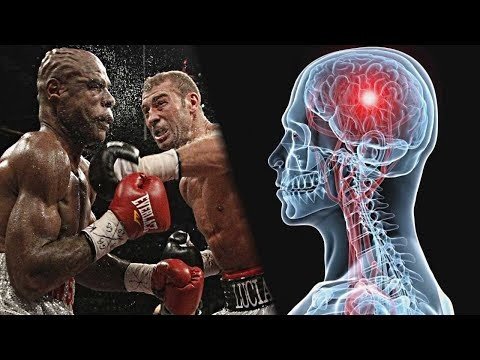 Анатомия нокаута. О чем умалчивают?!