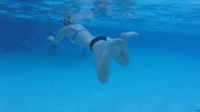 Акула укусила девушку за руку во время "безопасной" подводной экскурсии
