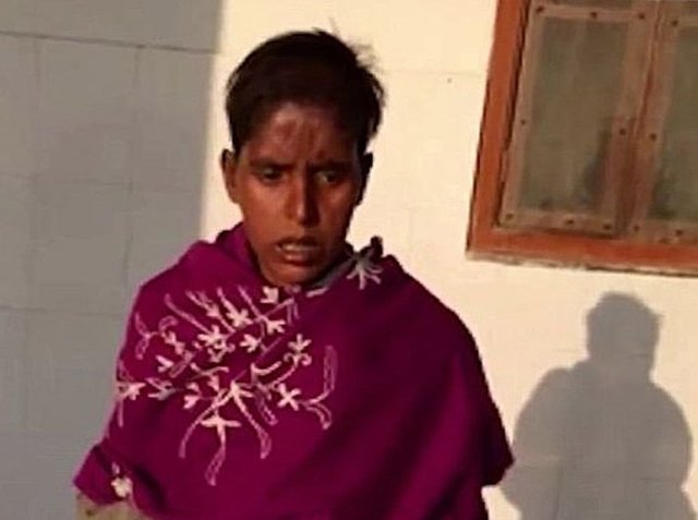В Индии спасли бездомную женщину, чью голову поедали личинки