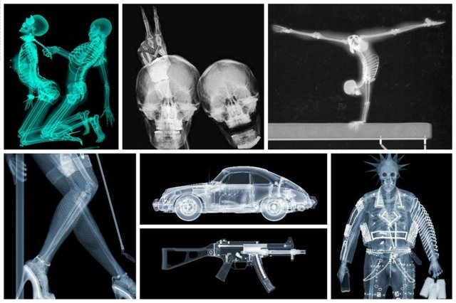 Мир в рентгеновских лучах - вид искусства, где видна изнанка бытия