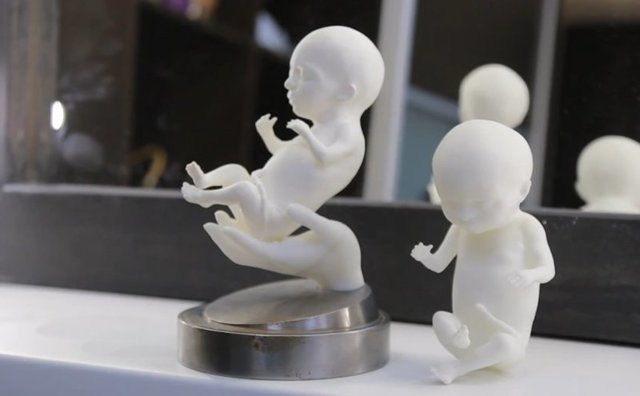 Будущие родители могут напечатать 3d модель своего не рожденного ребенка