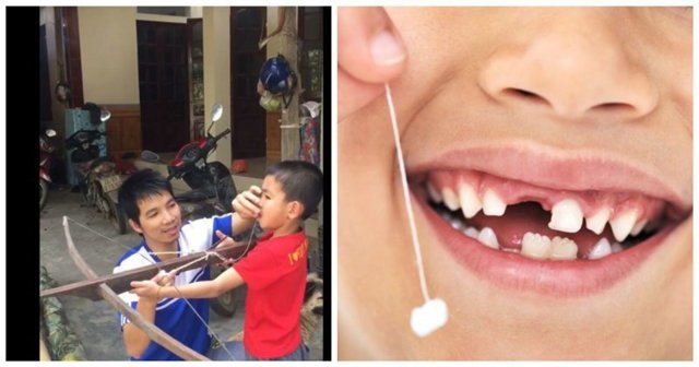 Вьетнамец удалил сыну зуб с помощью арбалета: видео