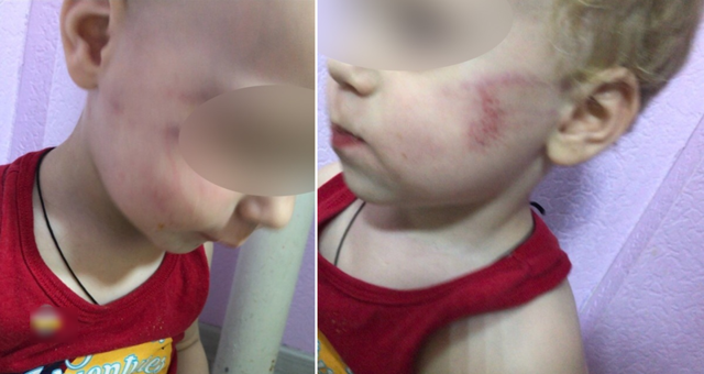 Воспитатель избила и заперла малыша в туалете из-за плача