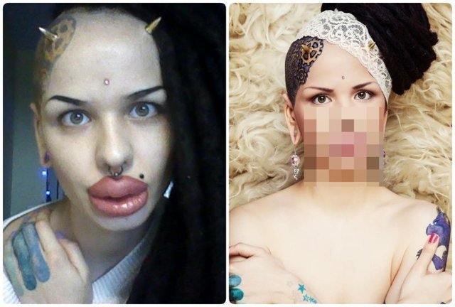 Помните россиянку, которая сделала 100 инъекций в губы? Просто взгляните, что с ней стало сегодня