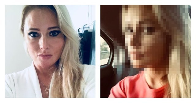 Недотянули: Дана Борисова продемонстрировала лицо после пластики
