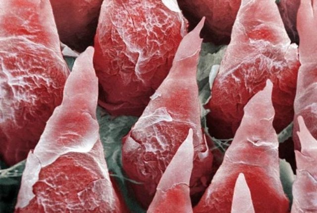 Вот как выглядит ваше тело под микроскопом
