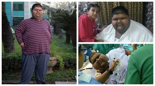Самый толстый мальчик в мире уменьшил себе желудок и похудел на 100 кг