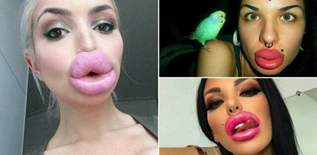 10 девушек ну с очень большими губами