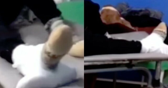 Очумелые ручки: башкирские врачи наложили на перелом шину из швабры