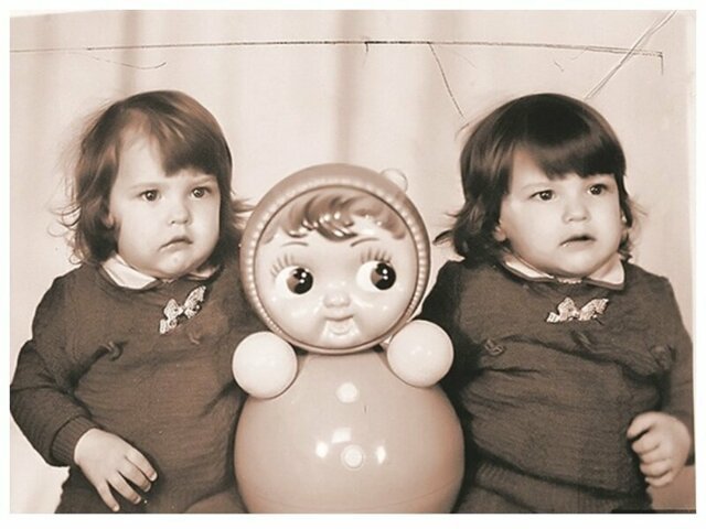 Первые удачно разделенные в СССР сиамские близнецы Аня и Таня Коркины: как они выглядят сейчас