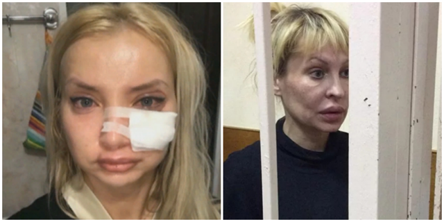 Горе-косметолог изуродовала почти два десятка человек и села в тюрьму