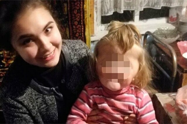 Башкирскую девочку с нестадартной внешностью не захотели принимать в детский сад