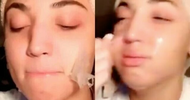 Блогерша час пыталась снять косметическую маску и едва не сорвала кожу лица