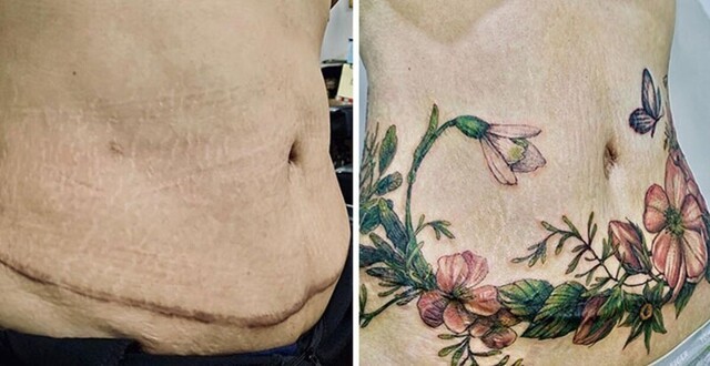 25 татуировок для перекрытия шрамов и других дефектов на теле