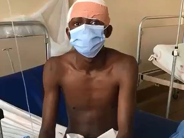 В Анголе кто-то воткнул гигантский нож в лоб мужчине