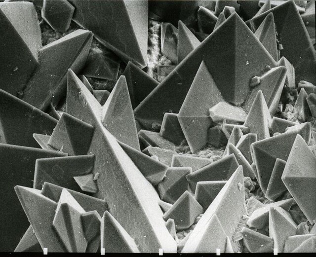 Камень в почках под микроскопом
