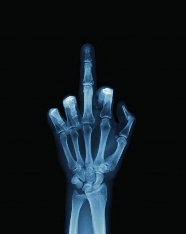 8 ноября 1895 г. 125 лет назад, физик Вильгельм Рентген открыл «рентгеновские лучи»