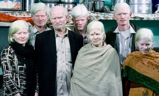 В Индии живет самая большая в мире семья альбиносов