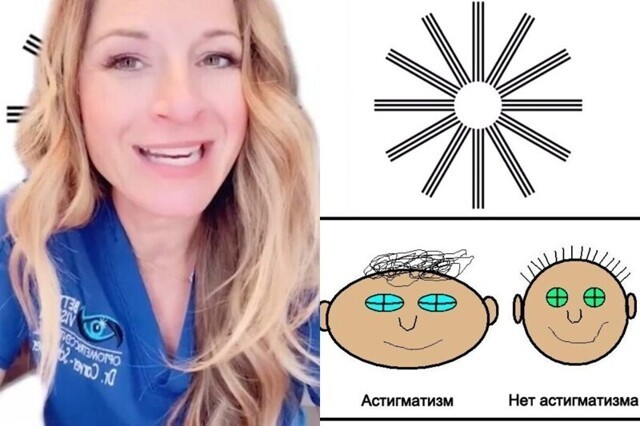 Тест на астигматизм: врач-окулист поделилась простым способом, помогающим определить дефект зрения