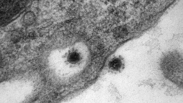 Как выглядит дельта-штамм коронавируса