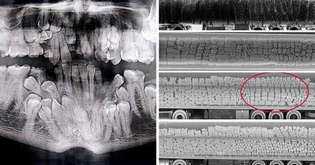 Рентгеновские снимки, от которых невозможно оторвать глаз