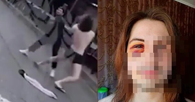 "Веди себя как мужчина!": туриста в Лазаревском избили из-за длинных волос
