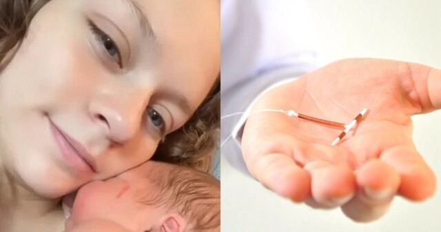 Киндер-сюрприз: жительница США родила ребёнка, сжимавшего в руке противозачаточную спираль
