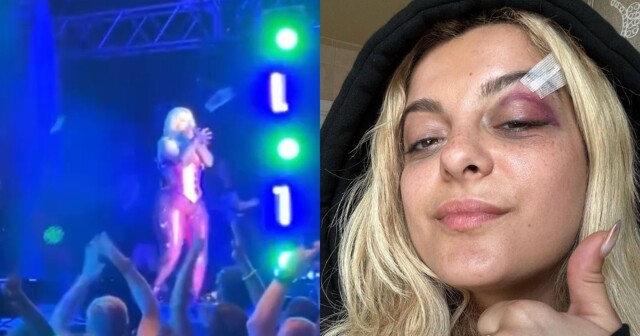 Певице Bebe Rexha разбили лицо смартфоном прямо во время выступления