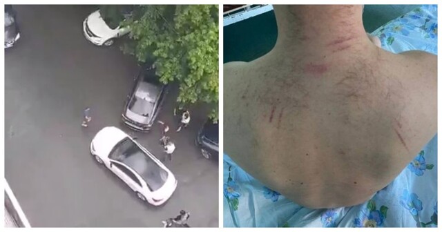 В Новосибирске парня исцарапала автоледи за то, что он ей не уступил дорогу